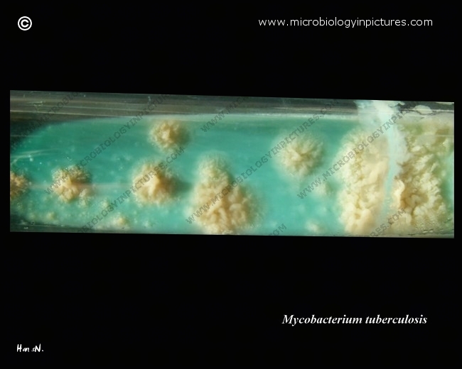 colonies on Lowenstein-Jensen medium